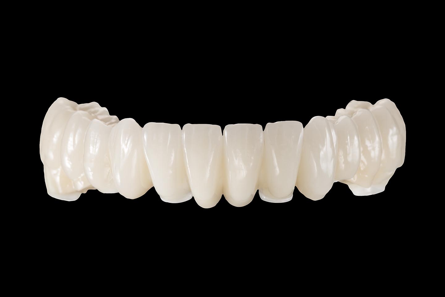 Gaumenplatte mit zahnprothese oberkiefer Zahnprothese Oberkiefer