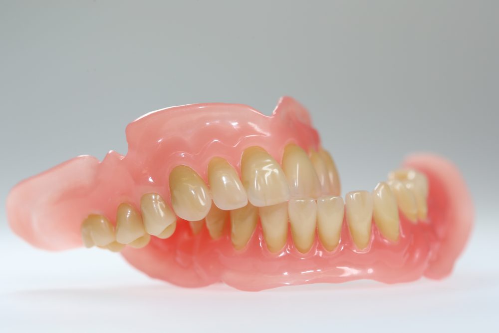 Oberkiefer erfahrungen klammerprothese Zahnprothesen